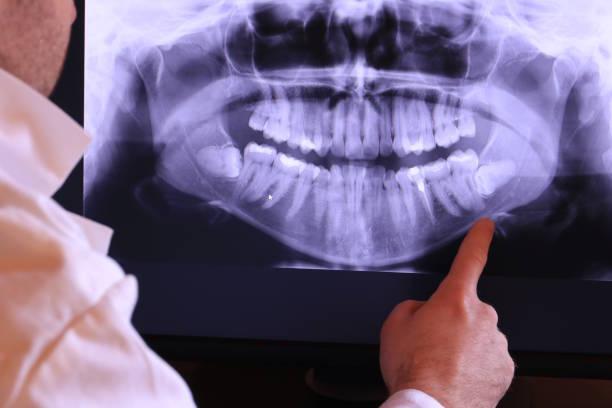 Best Emergency Root Canal Therapy in Daisetta, TX